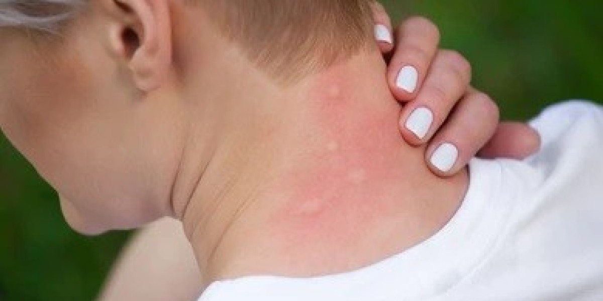 Fenbendazole 500 mg: Trusted Antiparasitic Treatment For human